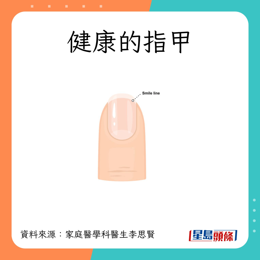 健康指甲