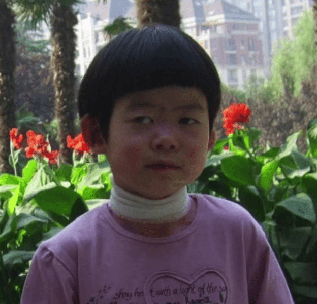 高尚好出生後在ICU住了166天後出院,她右眼失明,被醫生斷言「活不過兩歲」。 高尚好出生後在ICU住了166天後出院,她右眼失明,被醫生斷言「活不過兩歲」。