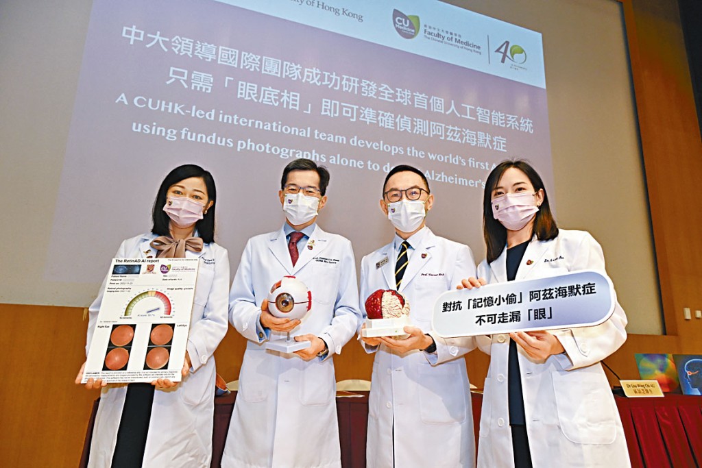 左起：張艷蕾博士、譚智勇講座教授、莫仲棠教授、區穎芝醫生。