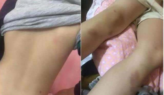 湖南長沙一位爸爸逼6歲兒學古人「懸樑刺股」 。(網圖)