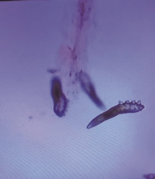 显微镜下的蟎虫。(图片与当事人无关)