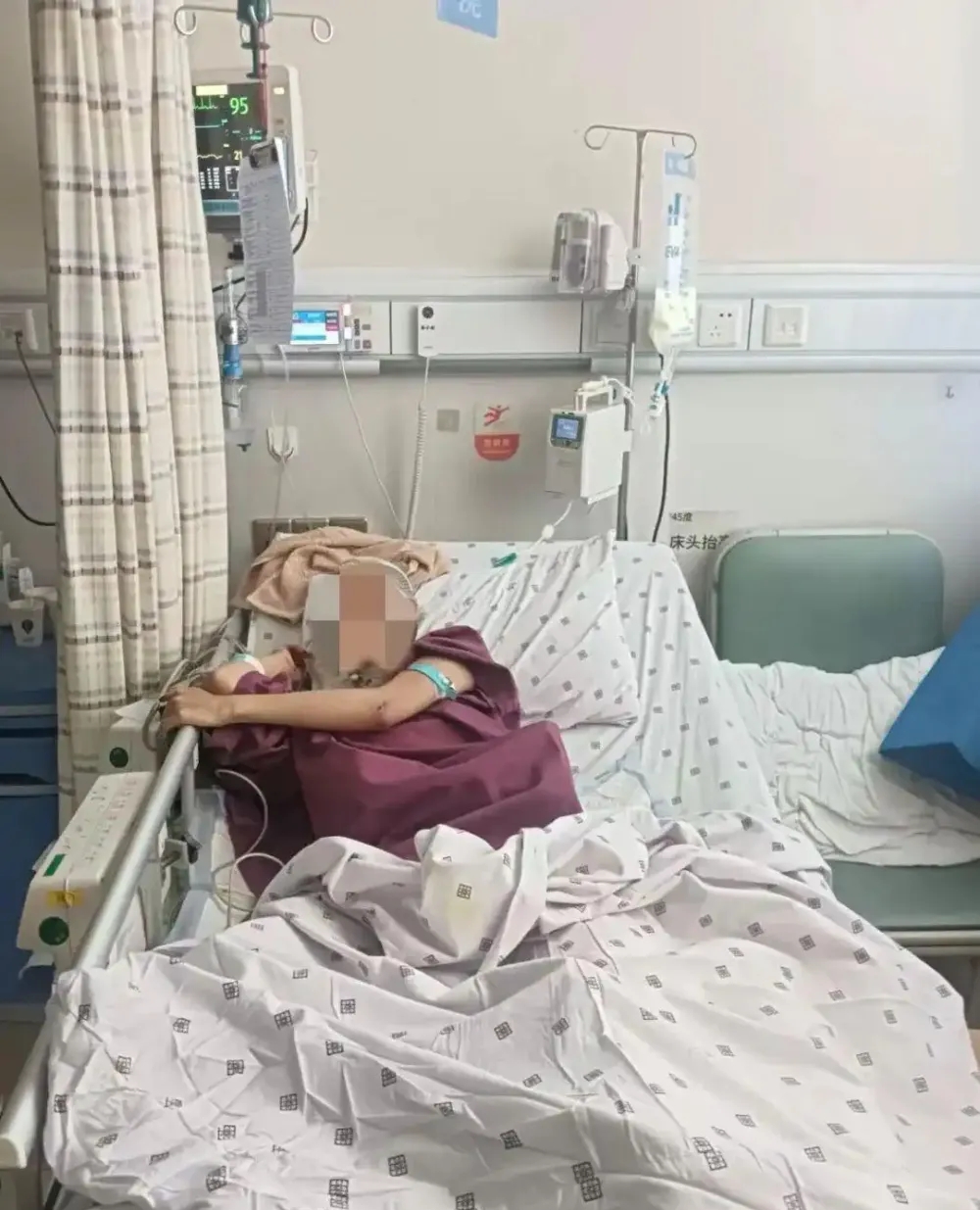 从18楼堕下奇蹟生还的浙江20岁女孩已苏醒做完笔录。