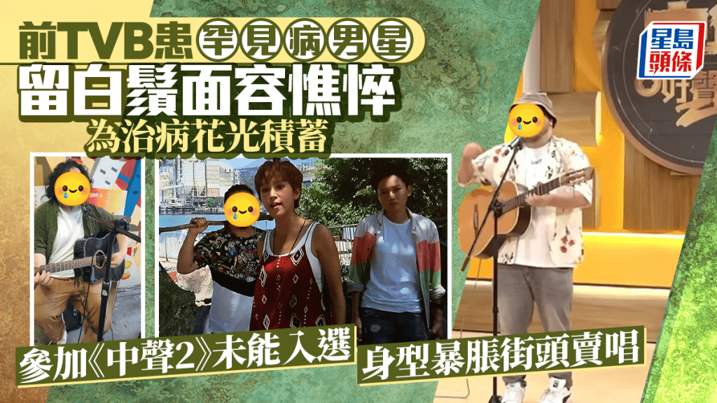 前TVB罕見病男星滿臉白鬚面容憔悴 為治病花光積蓄 參加《中聲2》未能入選現街頭賣唱