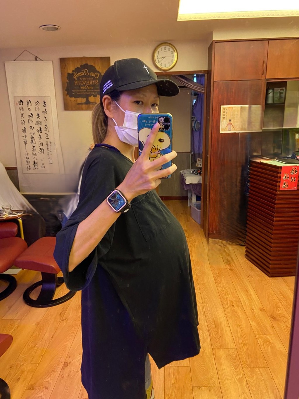 江小姐接受移植前相片。 江小姐接受移植前相片。