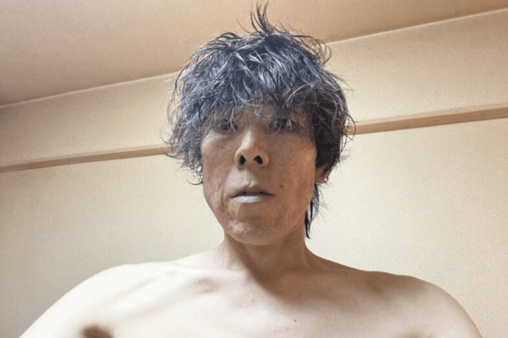 Kimbae昨日（18日）早上在社交平台上傳自己的最新情況，照片中的他臉色極差。
