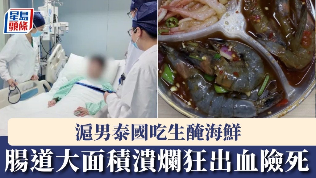 滬男泰國吃生醃海鮮感染痢疾阿米巴，腸道大面積潰爛狂出血險死。 