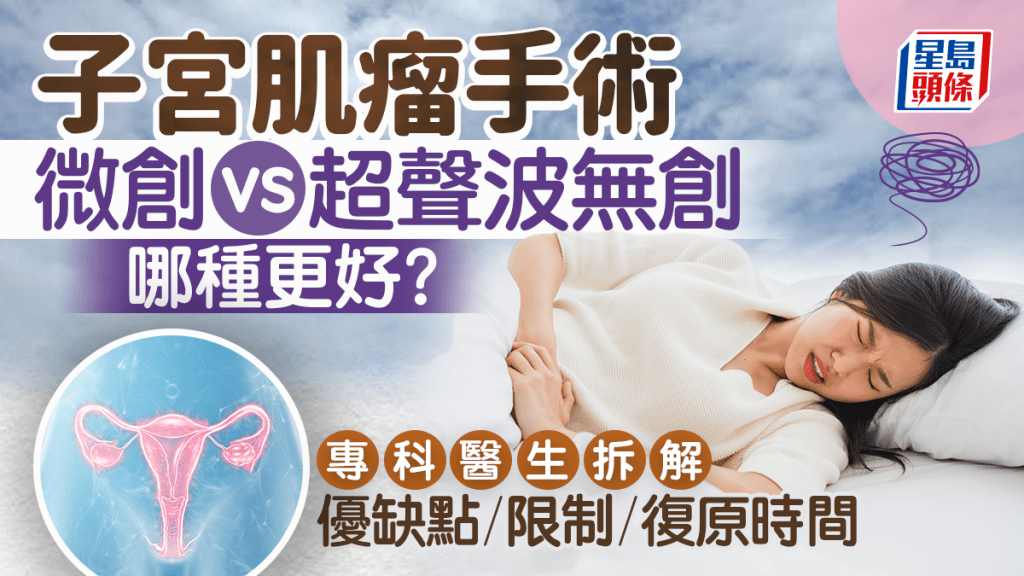 子宮肌瘤手術｜微創vs超聲波無創哪種好？ 專科醫生拆解優缺點/限制/復原時間