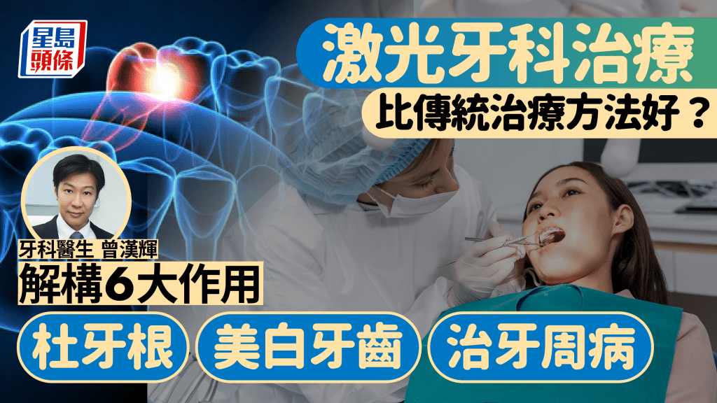 甚麼是激光牙科治療？牙醫解構6大作用 杜牙根/美白牙齒/治療牙周病