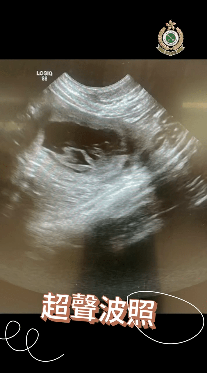 關員由起居飲食、產前檢查到產前運動，「樣樣做到足」。