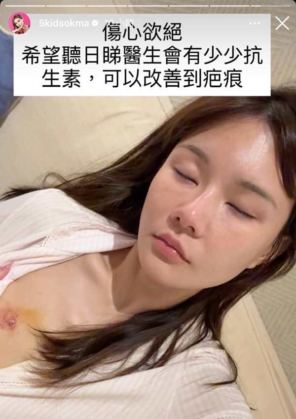 五索胸部傷口曝光，闊約兩吋觸目驚心。