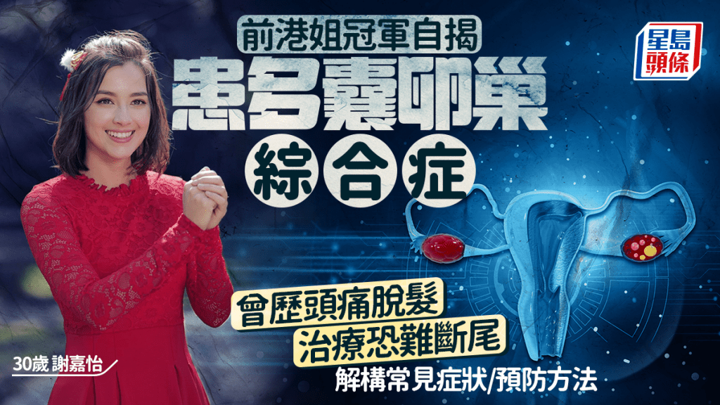 30歲前港姐冠軍自揭患多囊卵巢綜合症 曾歷頭痛脫髮治療恐難斷尾 解構症狀/預防方法