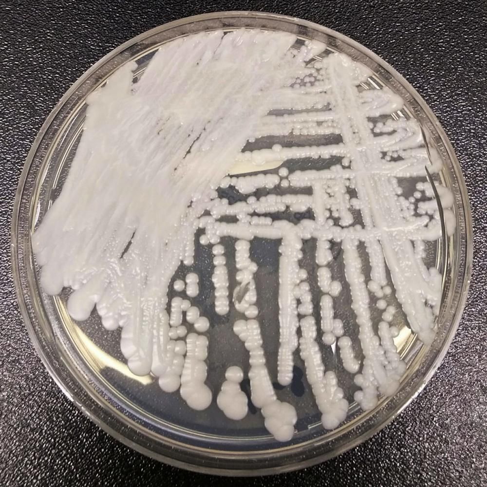 在較溫暖的溫度下培養的隱球菌中，「跳躍基因」的移動速度要高出五倍。AP資料圖片
