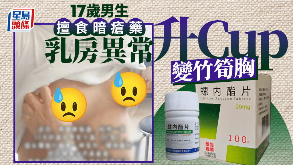 杭州17歲男擅食暗瘡藥  皮膚靚了乳房卻升Cup了
