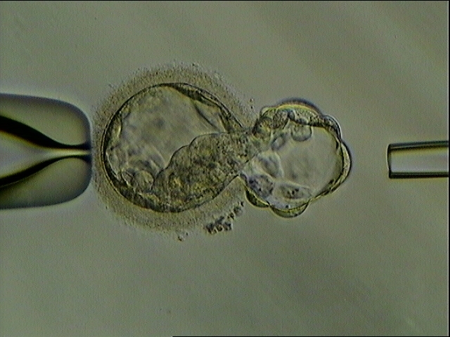 英美科學家成功利用幹細胞創造出合成人類胚胎。