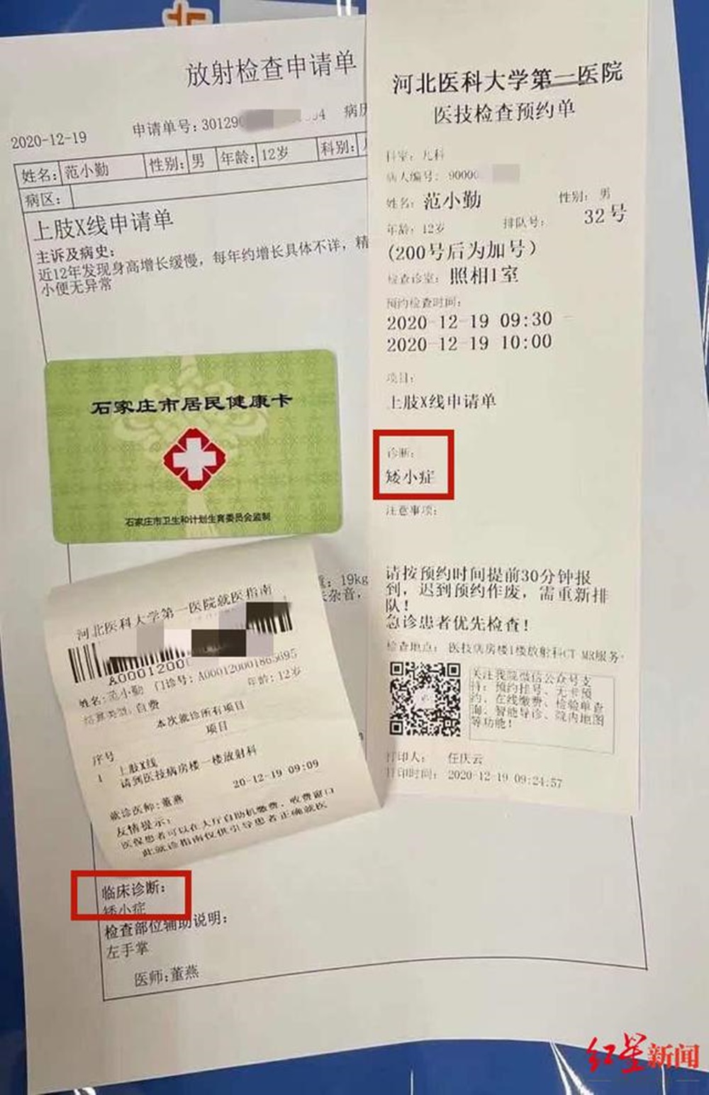 王雲輝提供診斷報告，顯示12歲范小勤被診斷出患有矮小症。網圖