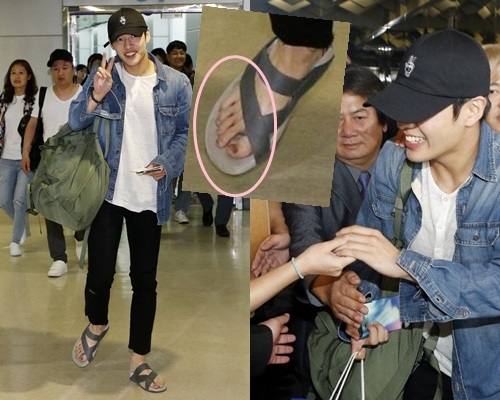 Oppa，清清腳趾瘀血好啲噃。（網上圖片）