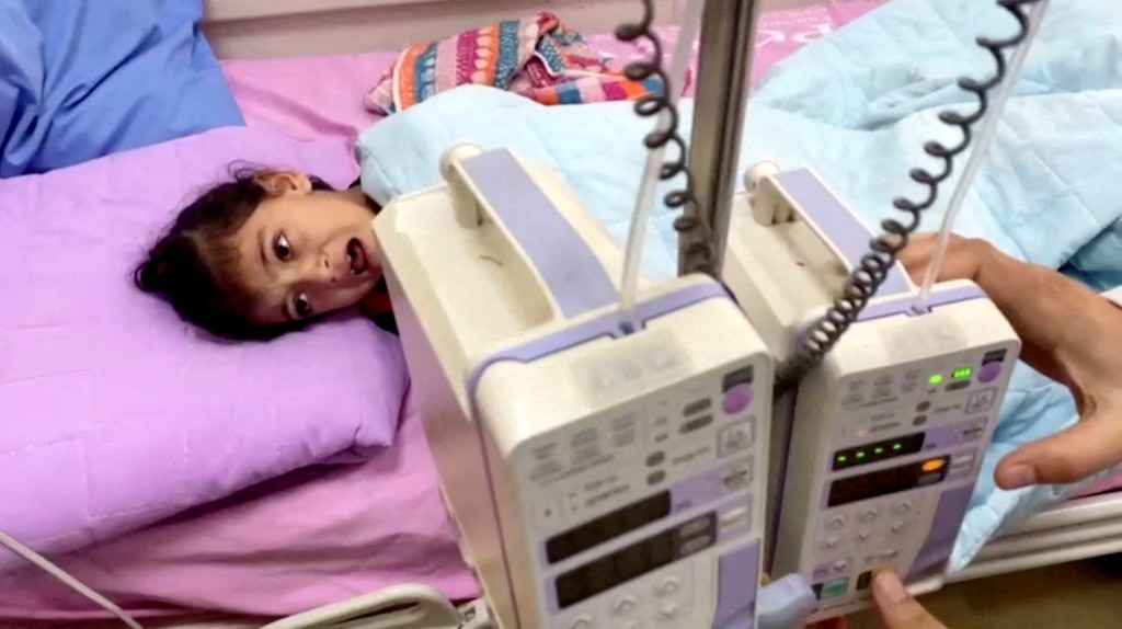 兰提西儿科医院一名患癌女童正接受治疗。路透社