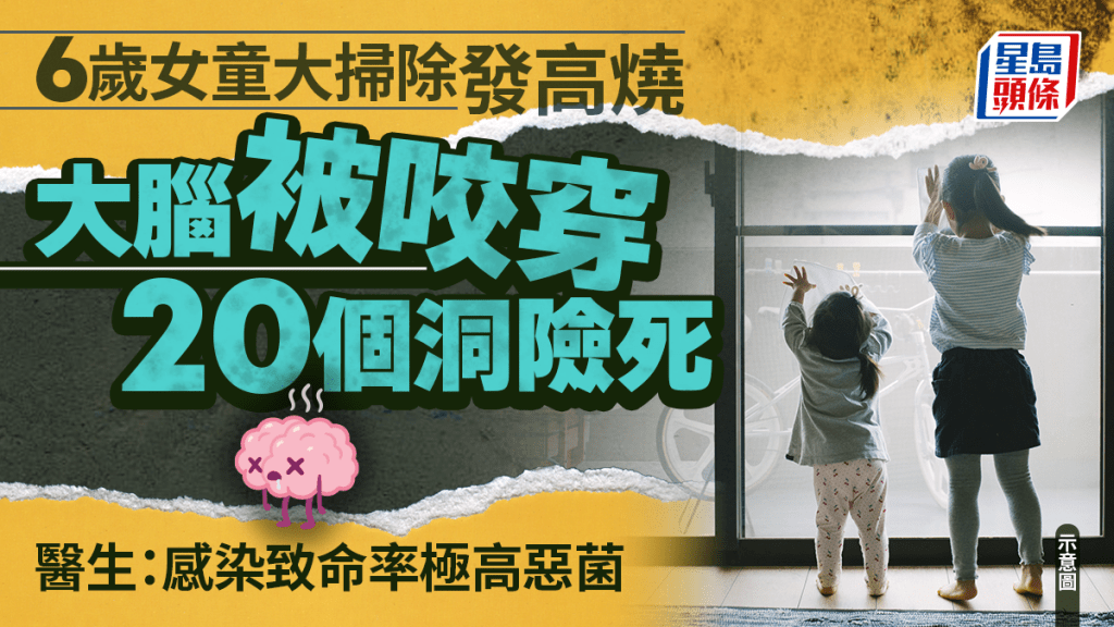 6歲女童大掃除後發高燒 大腦被咬穿20個洞險死 醫生揭感染1致命率極高惡菌