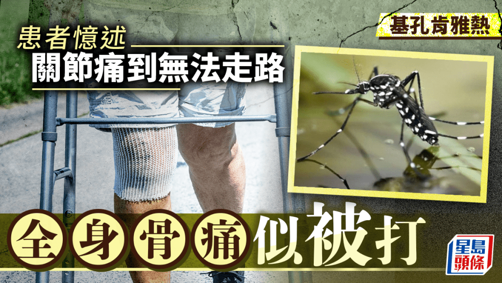 基孔肯雅熱︱南京患者憶述痛到不能走 「全身骨痛像被人打過」