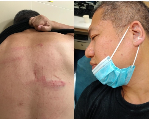 梁金成遭撒粉末及籐條虐打。梁金成提供