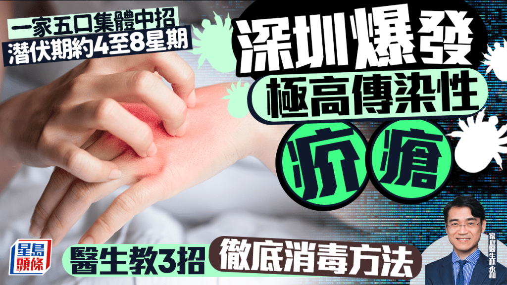 深圳爆發極高傳染性疥瘡 一家五口集體中招 潛伏期約4至8星期 醫生教3招徹底消毒方法