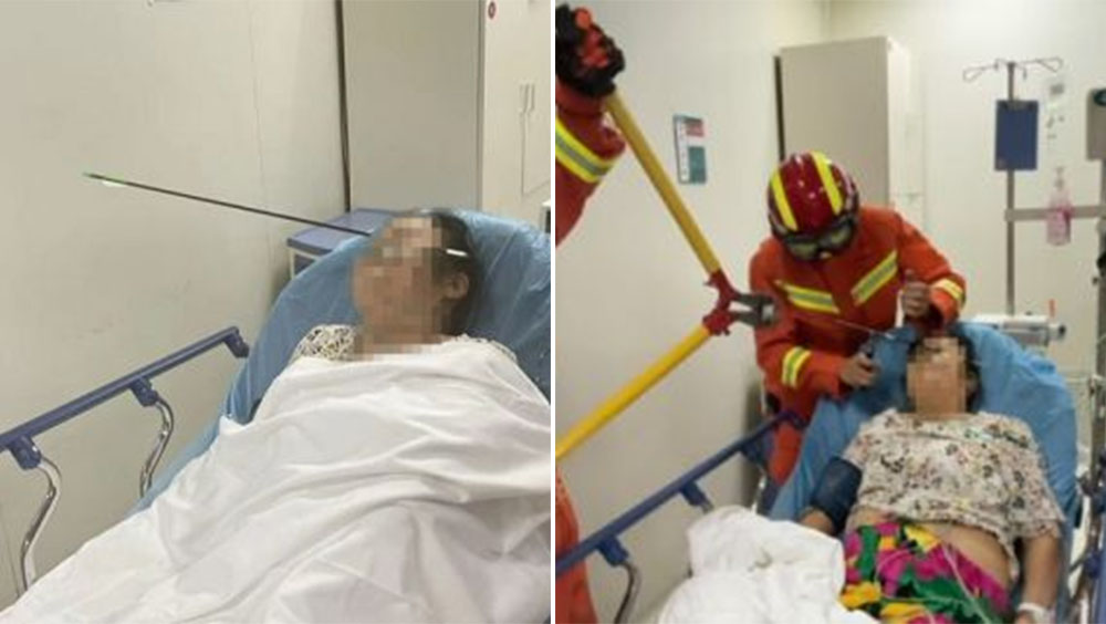 西安男小區玩弓箭誤中路人,大媽被射穿臉部。