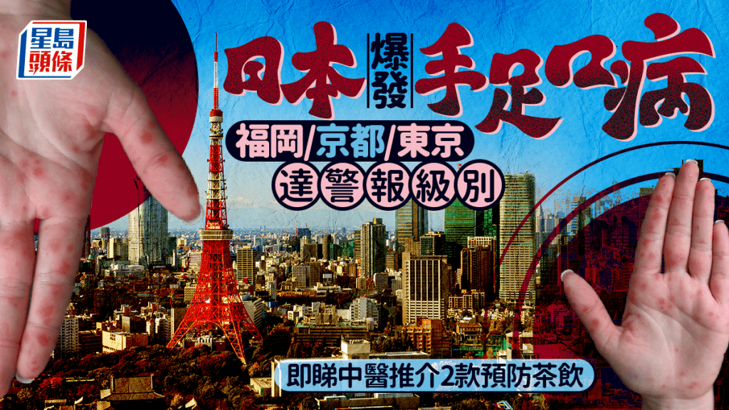 遊日注意！日本爆發手足口病  福岡/京都/東京達警報級別｜附中醫推介茶飲預防