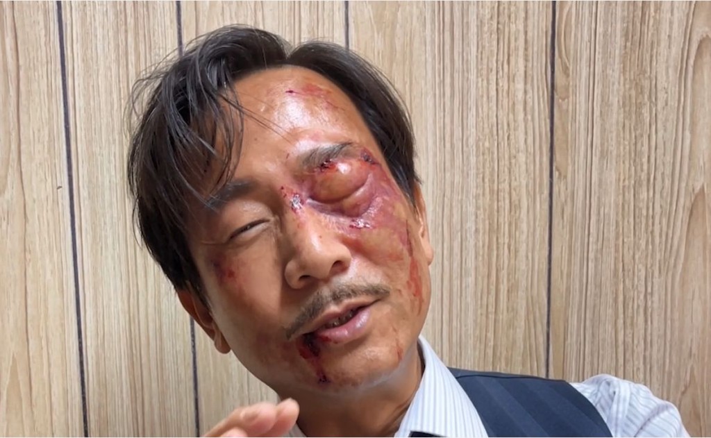 陳國邦左眼傷妝,也花了差不多三個小時坐定定讓化妝師「加工」。 陳國邦左眼傷妝,也花了差不多三個小時坐定定讓化妝師「加工」。