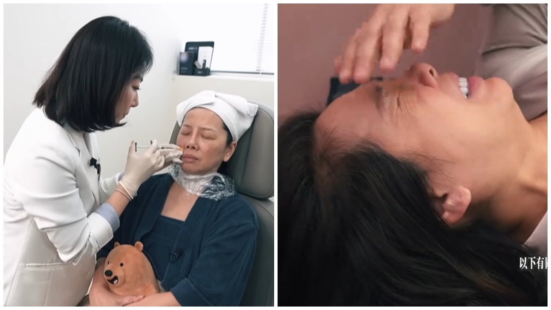 「御用師奶」黃梓瑋整容全直擊 告別肥師奶重返顏值巔峰 撞樣90年代性感女星關秀媚