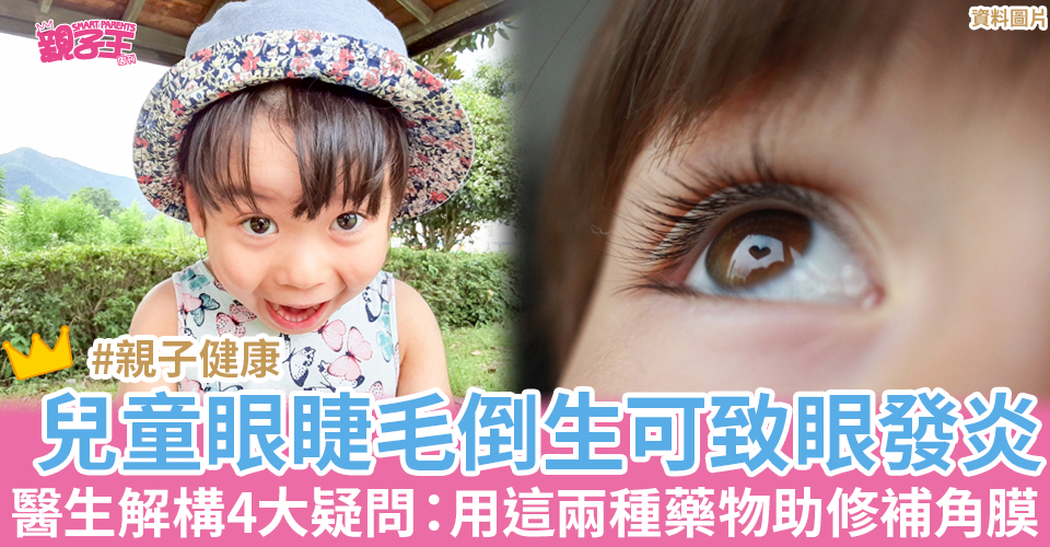 兒童出現眼睫毛倒生或會令眼睛發炎。(示意圖/圖片來源:PhotoAC)