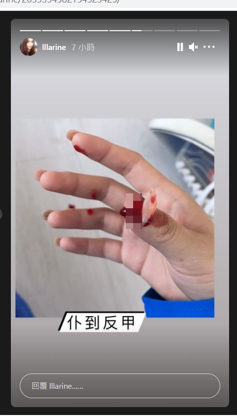 原來她「仆到反甲」！