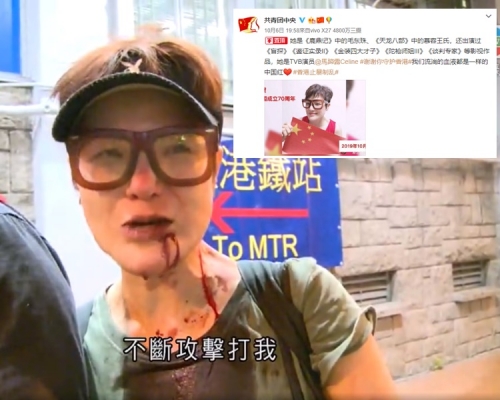 马蹄露受伤获共青团微博置顶发文表扬。（无线新闻截图／微博截图）