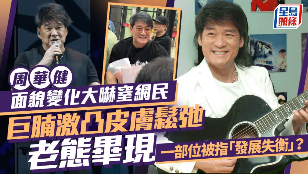 周華健面貌變化大嚇窒網民  巨腩激凸皮膚鬆弛老態畢現   一部位被指「發展失衡」？