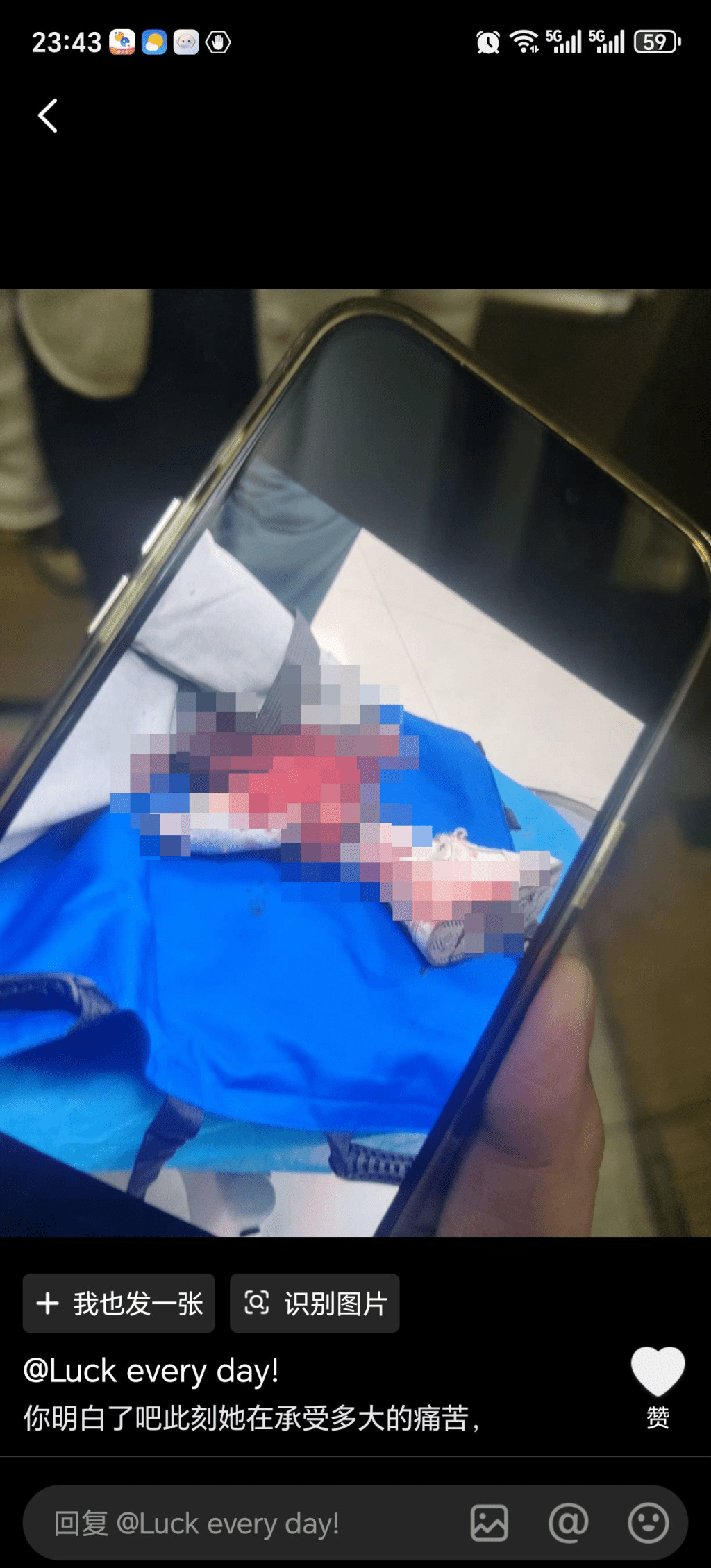 女乘客左小腿飞脱。 女乘客左小腿飞脱。