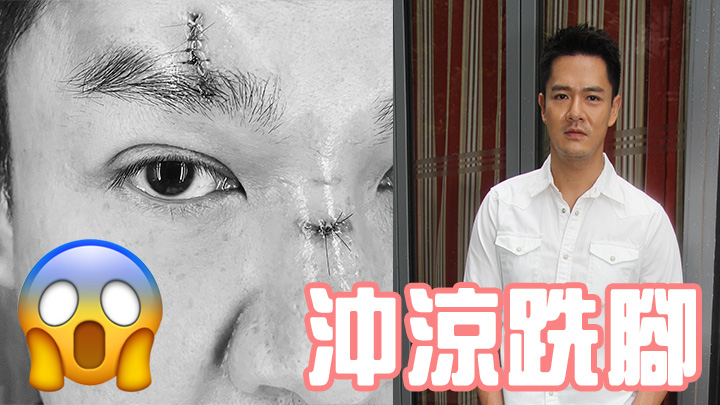 真係睇相都覺痛呀!