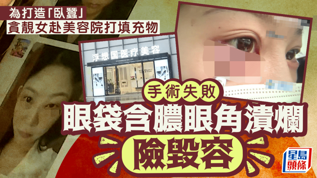 恐怖醫美︱貪靚女為「臥蠶」赴美容院注射填充物  手術失敗致眼肚含膿險毀容