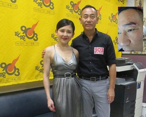 保怡眼角的傷已康復,同美君一齊宣傳歌曲。