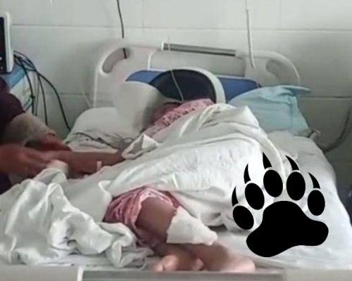 被熊追捕的小女孩目前病情穩定。(網圖)