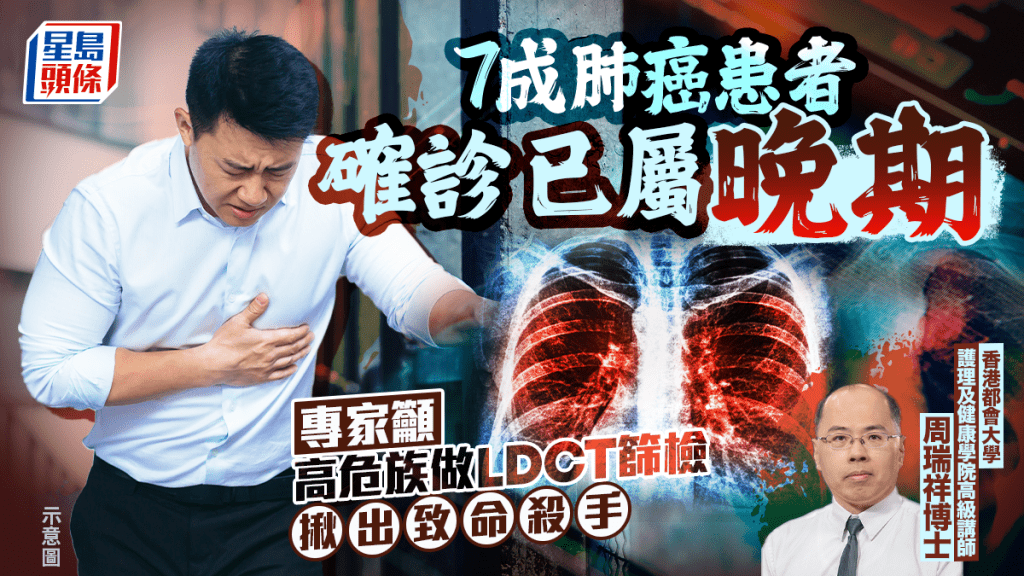 7成肺癌患者確診已屬晚期  專家籲 高危族做LDCT篩檢  揪出致命殺手