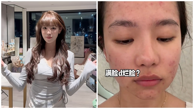 港姐2026丨溫思婷拒捏鼻驗證整容 被翻舊片曾自爆高考後「do鼻」兼用假胸墊造曲線