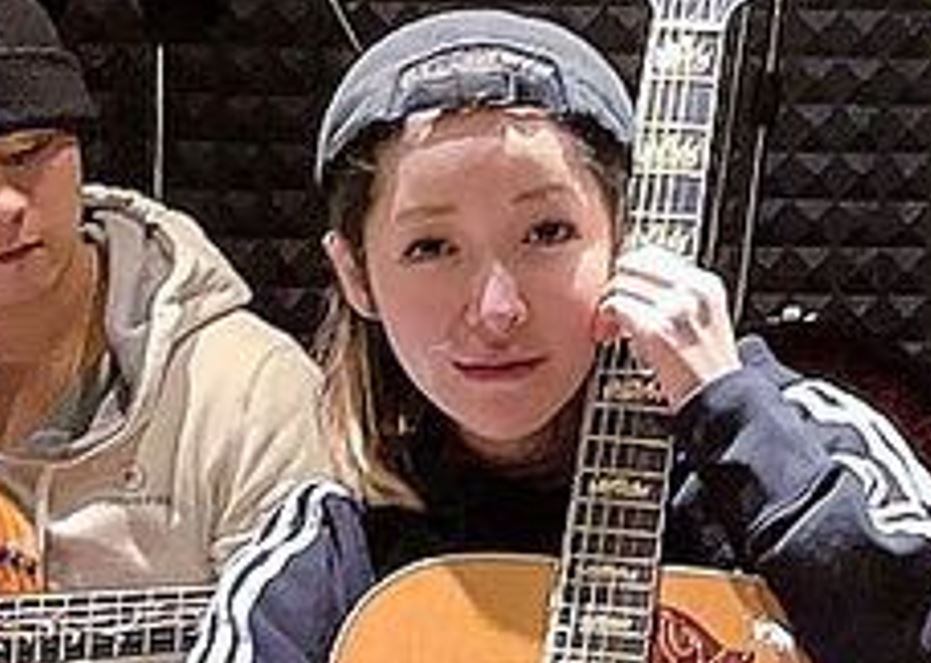 清楚見到右邊面、嘴唇上的疤痕。