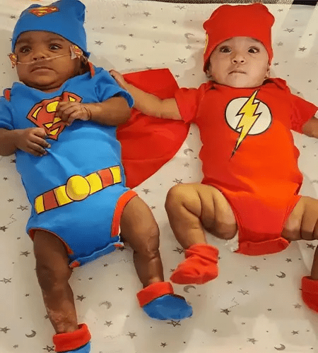 全球最早產雙胞胎慶1歲生日締造了奇蹟，成為現實世界的超級英雄。健力士官網