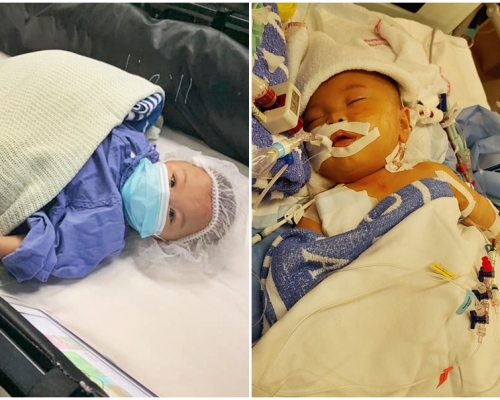早產嬰悅悅一出生便患有壞死性腸炎,至今已接受多次手術。「CoKa.Kona Baby」FB圖片