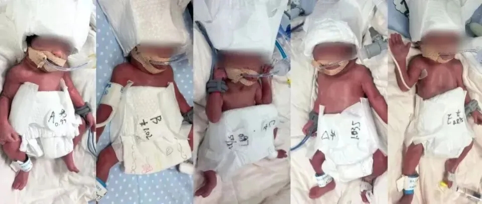 新疆的24歲產婦在武漢成功分娩五胞胎。 新疆的24歲產婦在武漢成功分娩五胞胎。