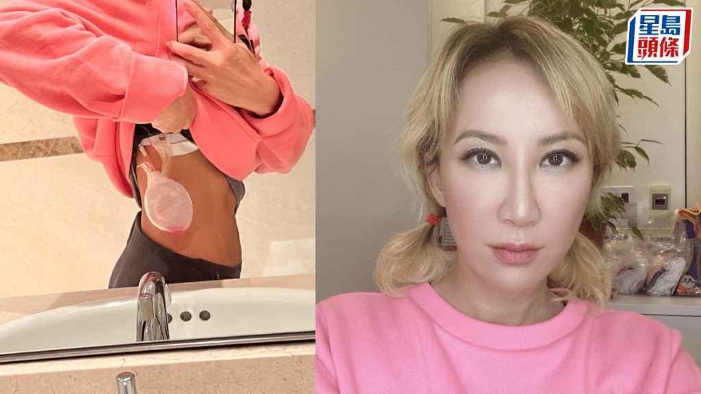 CoCo李玟逝世|李玟去年確診乳癌曾掛引流袋 乳房有6變化須求醫 常接觸塑化劑風險高