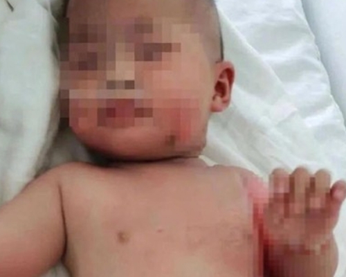 女嬰送院後仍意識模糊，更反覆嘔吐7次。 網圖