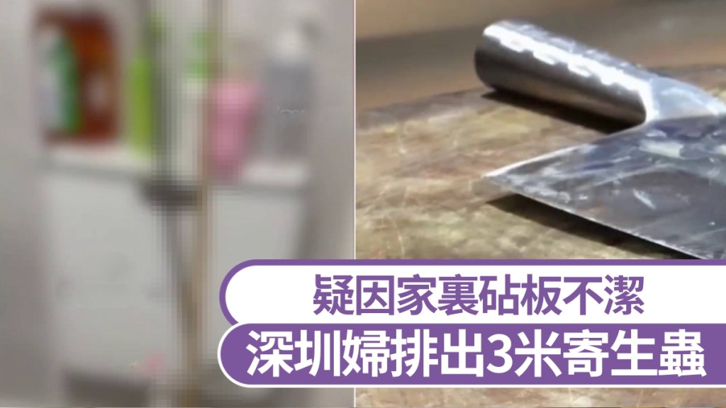 深圳女子疑因家裏砧板不潔，如廁排出3米寄生蟲。