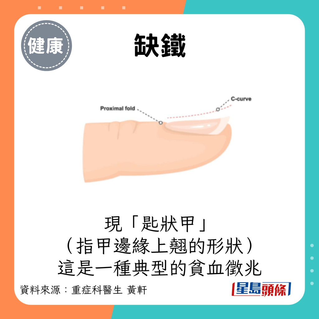 缺铁：现「匙状甲」（指甲边缘上翘的形状）