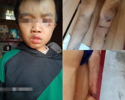 江西一名12歲男童滿身傷痕倒斃家中。 網圖