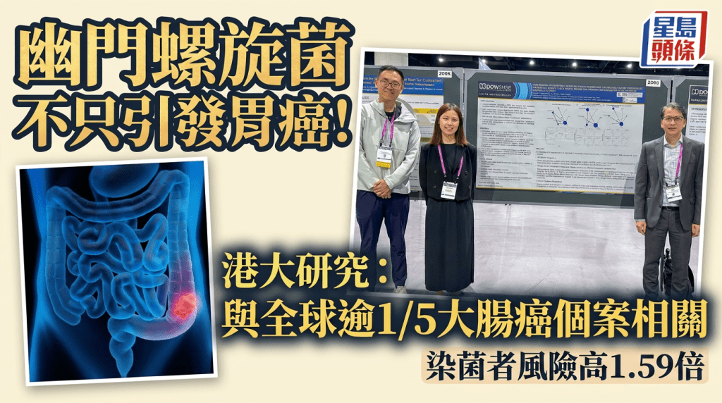幽門螺旋菌不只引發胃癌！港大研究揭與全球逾1/5大腸癌個案相關 染菌者風險高1.59倍
